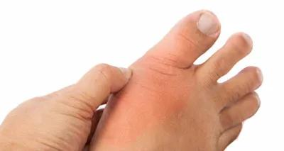 前脚掌疼痛,前足疼