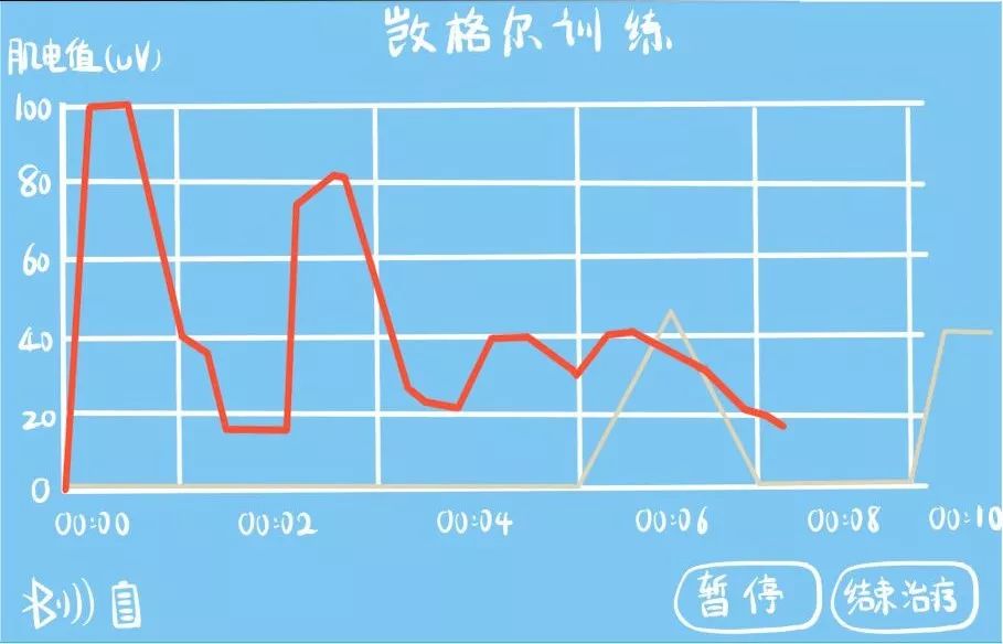 产后盆底功能障碍要做康复治疗吗,盆底功能障碍严重者需要治疗吗