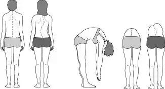 正美体态改善扁头是真的吗,成年人脊柱侧弯能恢复正常体态吗