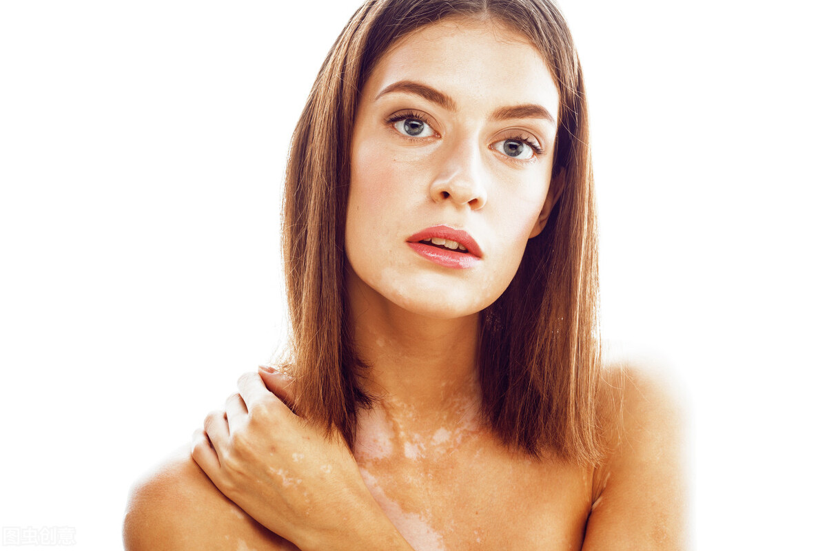 白癜风不治疗有危害吗,激素治疗白癜风的危害