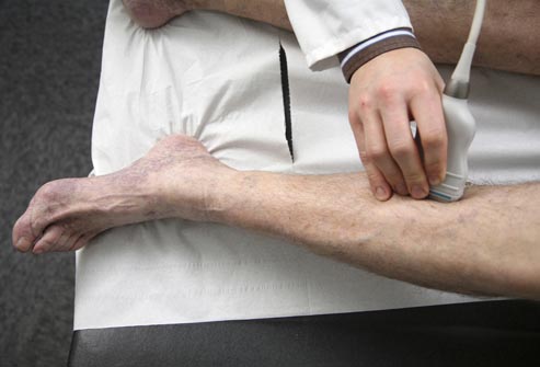 坐飞机太久会有什么综合症,坐飞机没休息对身体有什么影响