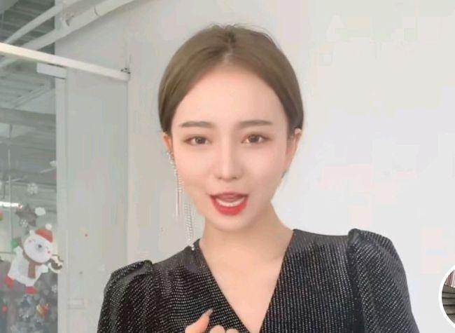 项思醒眼部整容史,项思醒整容了吗