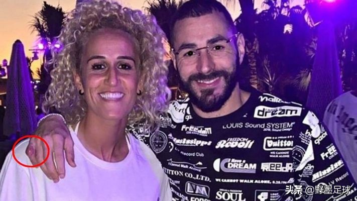 皇马的天才却因伤病困扰,皇马球员大面积受伤