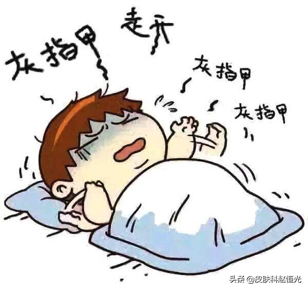 怎么预防脚上的灰指甲传染手上,灰指甲传染率高及时处理避免扩散