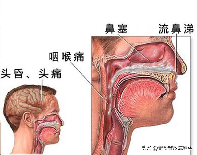 八十多岁的老太太胸腹总疼咋回事,76岁老人胸痛胸闷是怎么回事