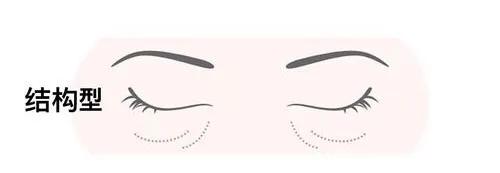 黑眼圈越来越重怎么搞定黑眼圈,简单有效缓解黑眼圈的两个小方法