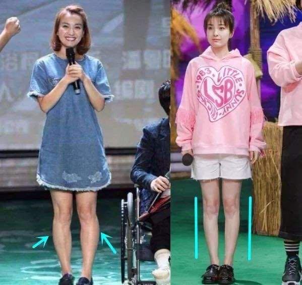 女子花8万做抽脂减肥,女子花68万做十次抽脂术