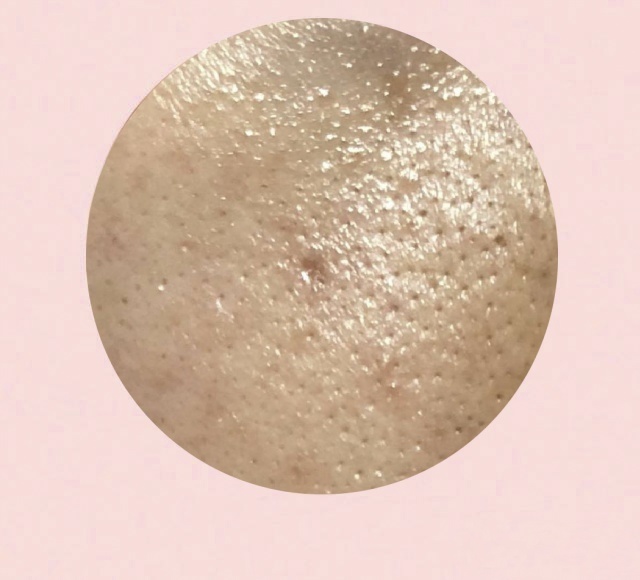 油皮毛孔粗大毛孔多要怎么改善,油皮毛孔粗大护肤品