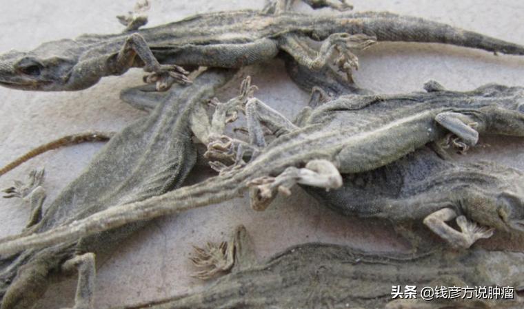 各种结节息肉用什么药最好,治疗各种结节息肉的方法