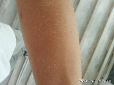 烟酰胺美白身体乳长毛吗,烟酰胺美白作用真的吗