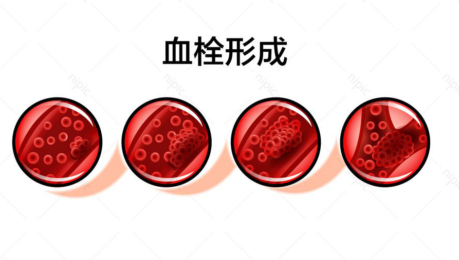 氨甲环酸治疗*褐斑黄**的那点事！避免风险，你需要的专业知识