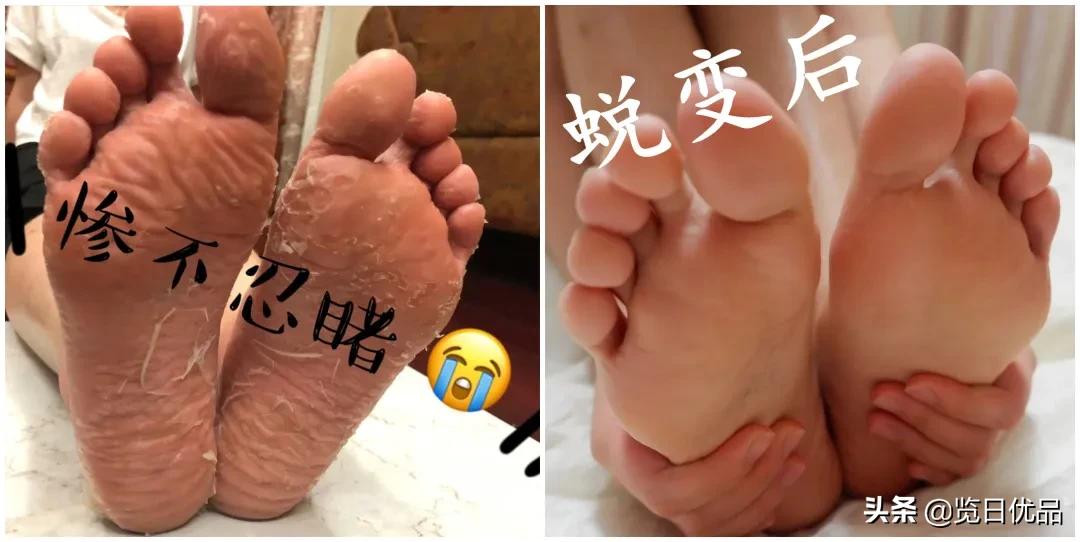 爽炸了！干丑裂的脚皮，一张完整撕掉，敢跟婴儿比姣嫩！
