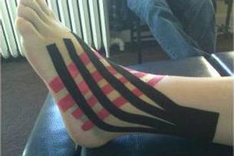 踝关节扭伤包扎,踝关节扭伤热敷