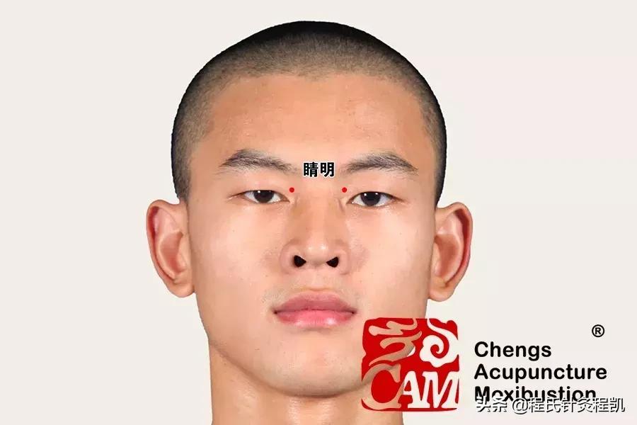 干眼症如何治疗相关推荐,干眼症如何治疗效果最好