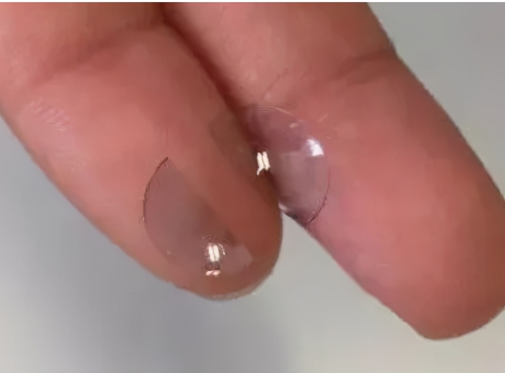 冬天戴角膜塑形镜旅行注意事项,角膜塑形镜超期使用