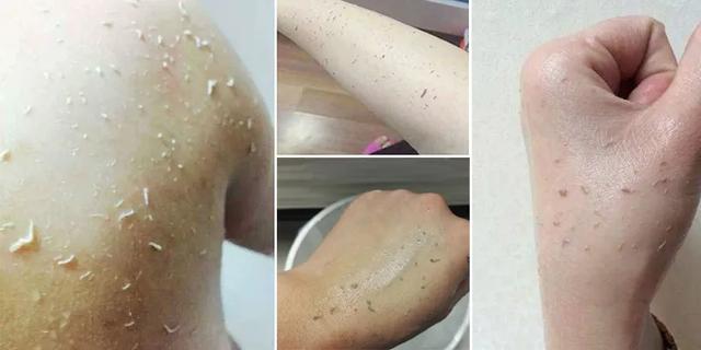 洗澡搓出来的泥每天都可以洗,洗澡搓出来的泥增多了