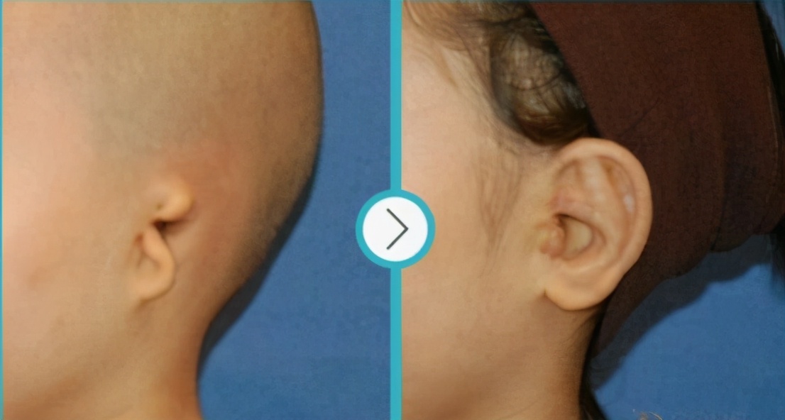 孩子六岁了父母应该注意哪些,小耳畸形的孩子要生吗