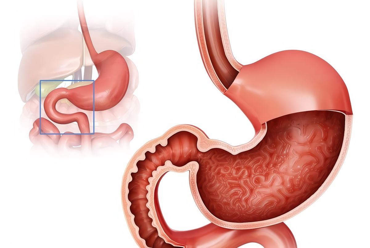 胃酸胃胀能吃牛奶饼干吗,胃溃疡胃酸能吃饼干吗