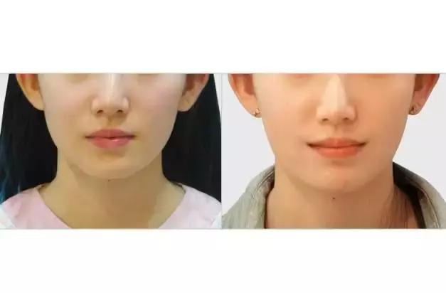 什么脸老了最容易显老,脸上有这5个特征的女人