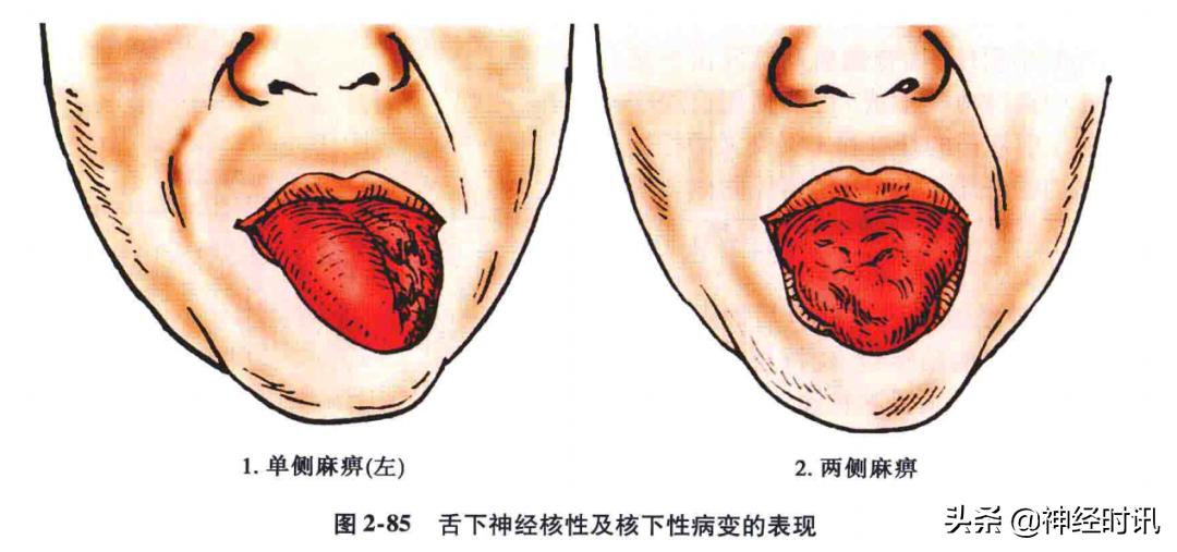 脑干解剖,脑干神经解剖