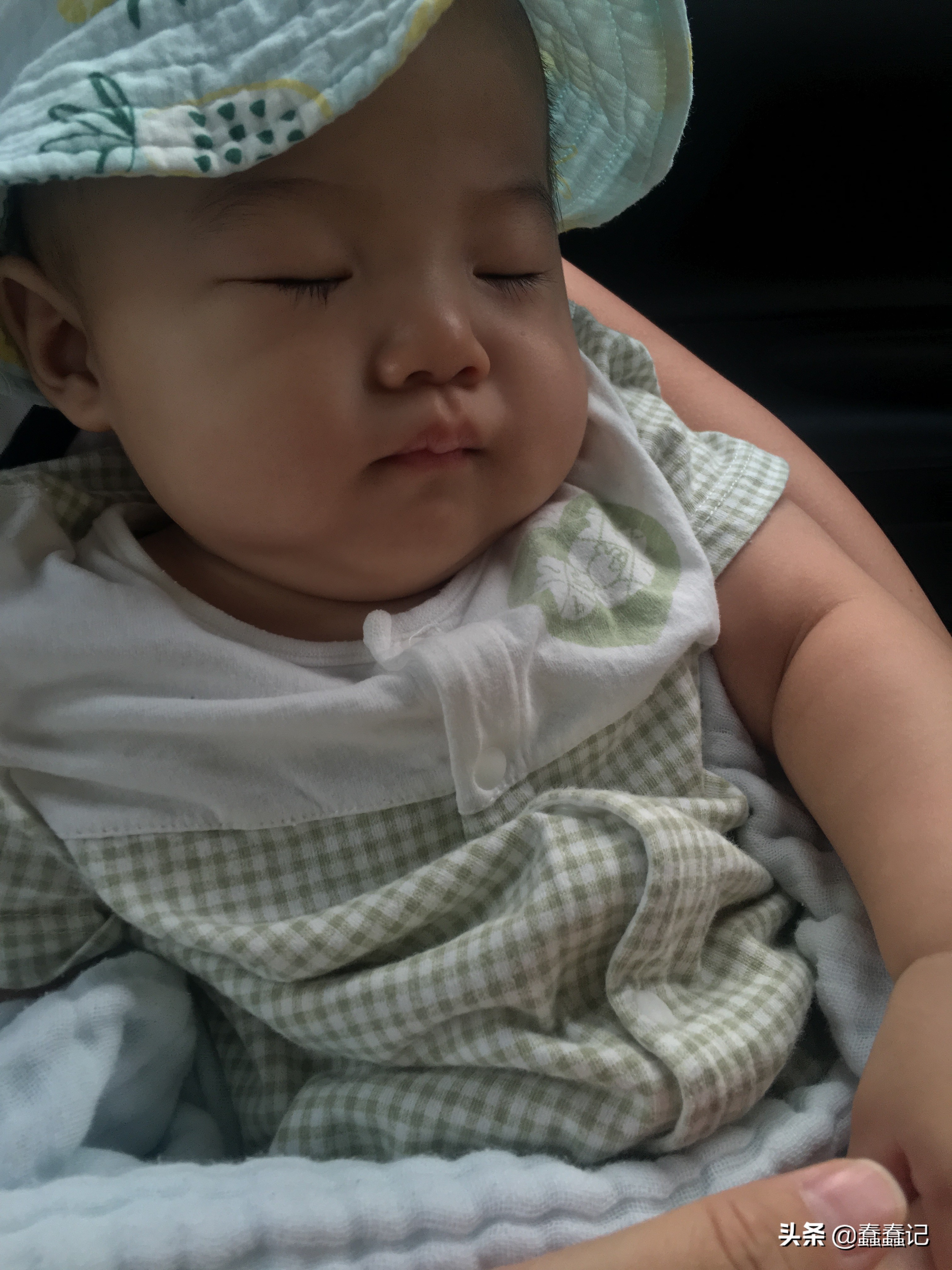 七个月检查宝宝头偏小,7个月婴儿头围40做核磁共振正常