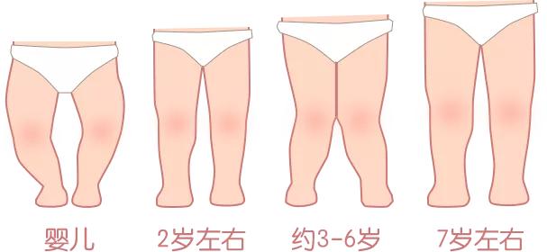 「星医百」纸尿裤影响生育、导致0型腿？纸尿裤的谣言，一次说清