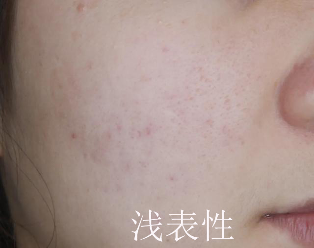 <html>
<head><title>502BadGateway</title></head>
<body>
<center><h1>502BadGateway</h1></center>
<hr><center>nginx</center>
</body>
</html>
<!--apaddingtodisableMSIEandChromefriendlyerrorpage-->
<!--apaddingtodisableMSIEandChromefriendlyerrorpage-->
<!--apaddingtodisableMSIEandChromefriendlyerrorpage-->
<!--apaddingtodisableMSIEandChromefriendlyerrorpage-->
<!--apaddingtodisableMSIEandChromefriendlyerrorpage-->
<!--apaddingtodisableMSIEandChromefriendlyerrorpage-->
