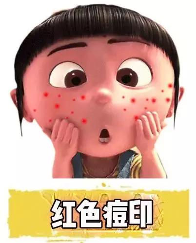 女生爆痘必买清单药膏,战痘效果最好的药