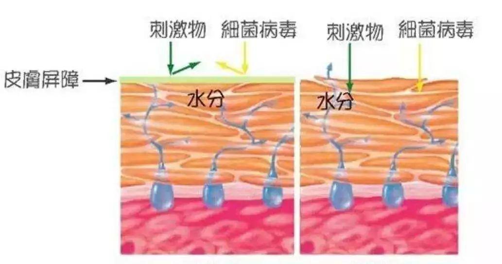 皮肤暗黄无光泽一招教你快速改善,怎么解决皮肤粗糙无光泽