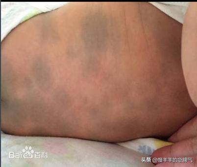 新生儿正常生理现象,新生儿正常生理现象哪四个