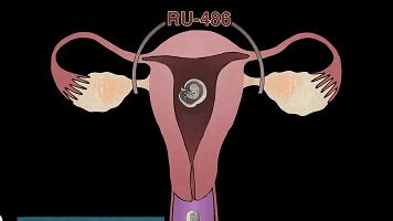 男用避孕药通过试验，网友：叫刘阳打针，半藏森林你不用吃药了