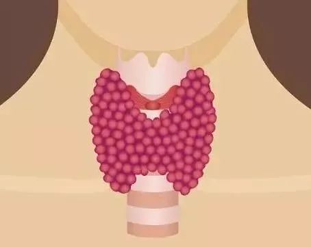 甲减终身吃药对寿命有影响吗,桥本甲减终身服药会影响寿命吗