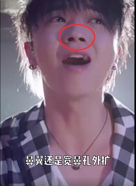 美妆网红晒华晨宇变脸过程质疑其做了3项整容手术，真的不怕被告