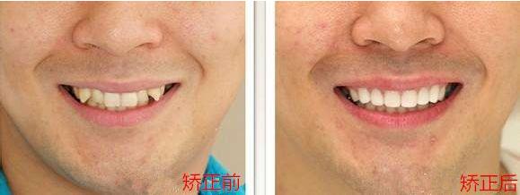 雅虎是什么意思啊,牙虎是什么