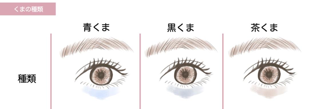 黑眼圈指南,干货告别黑眼圈看这三个按摩手法