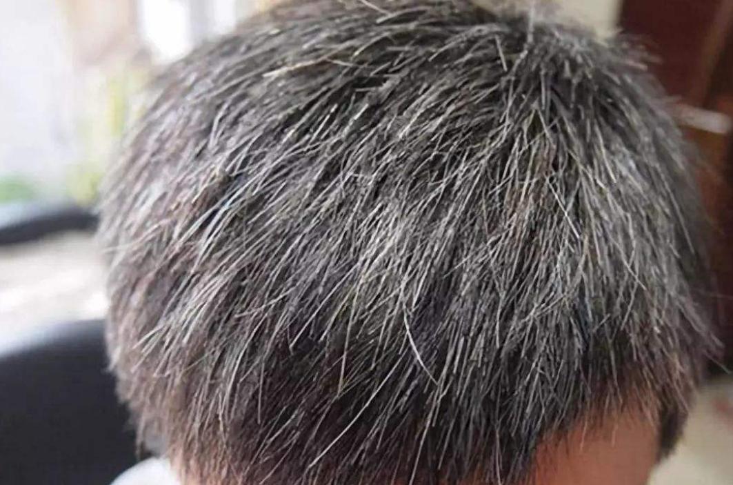 头顶有白发不染留什么发型好看,有白发怎么补染头发