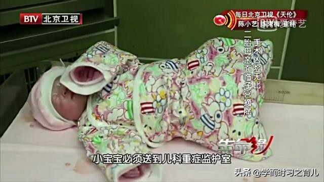 孕早期怎么知道是前置胎盘,孕早期能看出前置胎盘吗