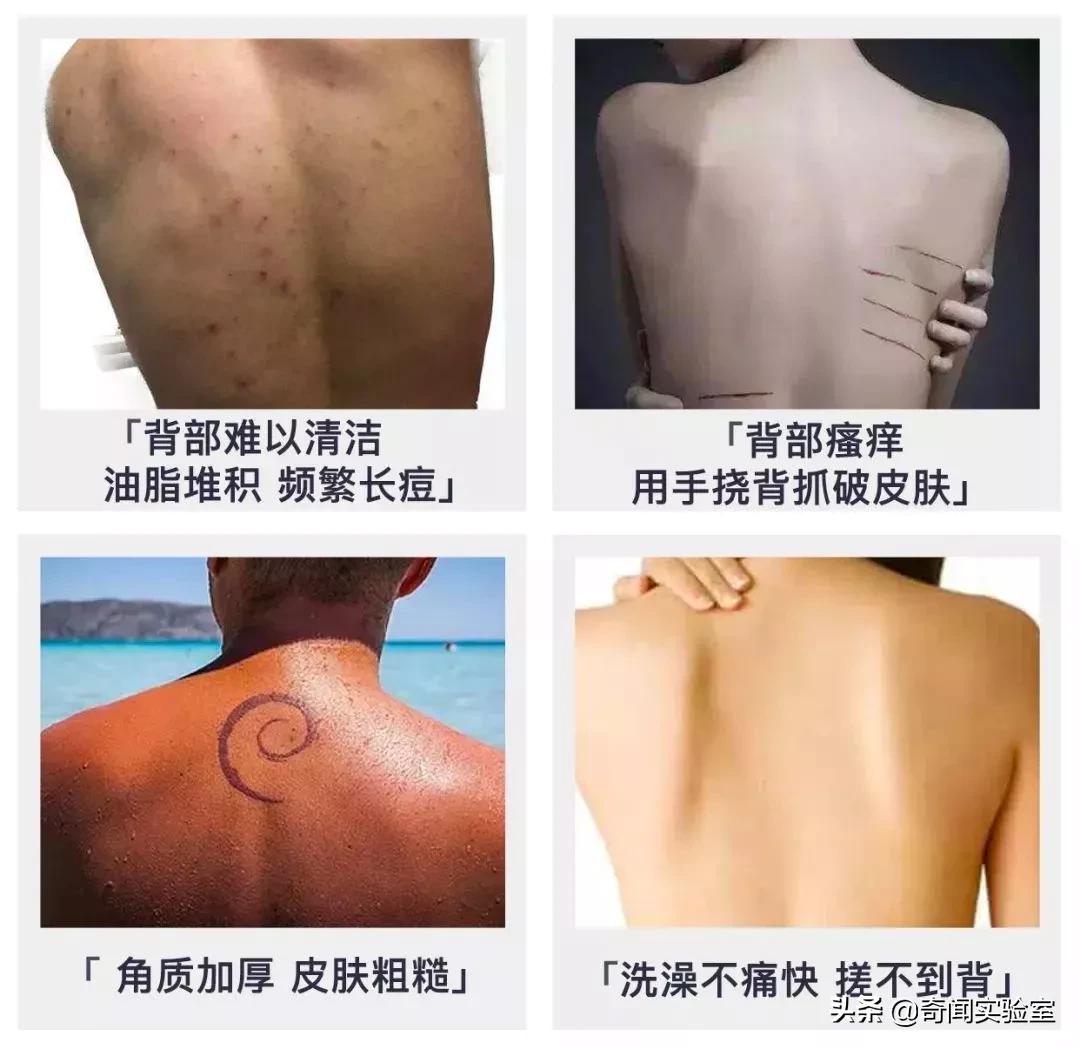 洗澡后背自己洗不掉怎么办,洗澡后背搓不到泥怎么回事