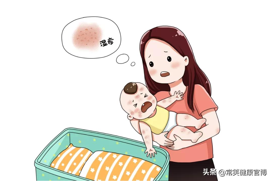 医院开的湿疹膏有激素吗,医生开了湿疹两种药膏要一起涂吗