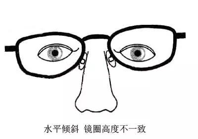 眼镜戴久了镜片模糊怎么清洗,生活小妙招眼镜不起雾