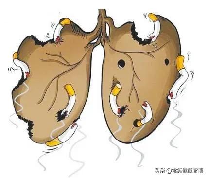 2022治好慢阻肺,慢阻肺晚期死前症状