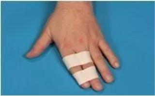 干货!国家体育总局运动医学博士的总结:运动损伤的急救和预防