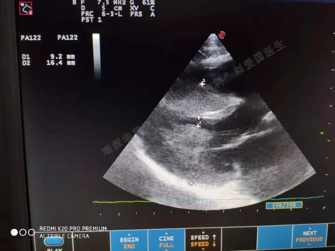 牛心脏疾病,牛心脏上有哪些疾病