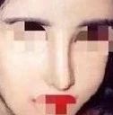为什么做完鼻子看起来很假,鼻子做得很假是什么原因