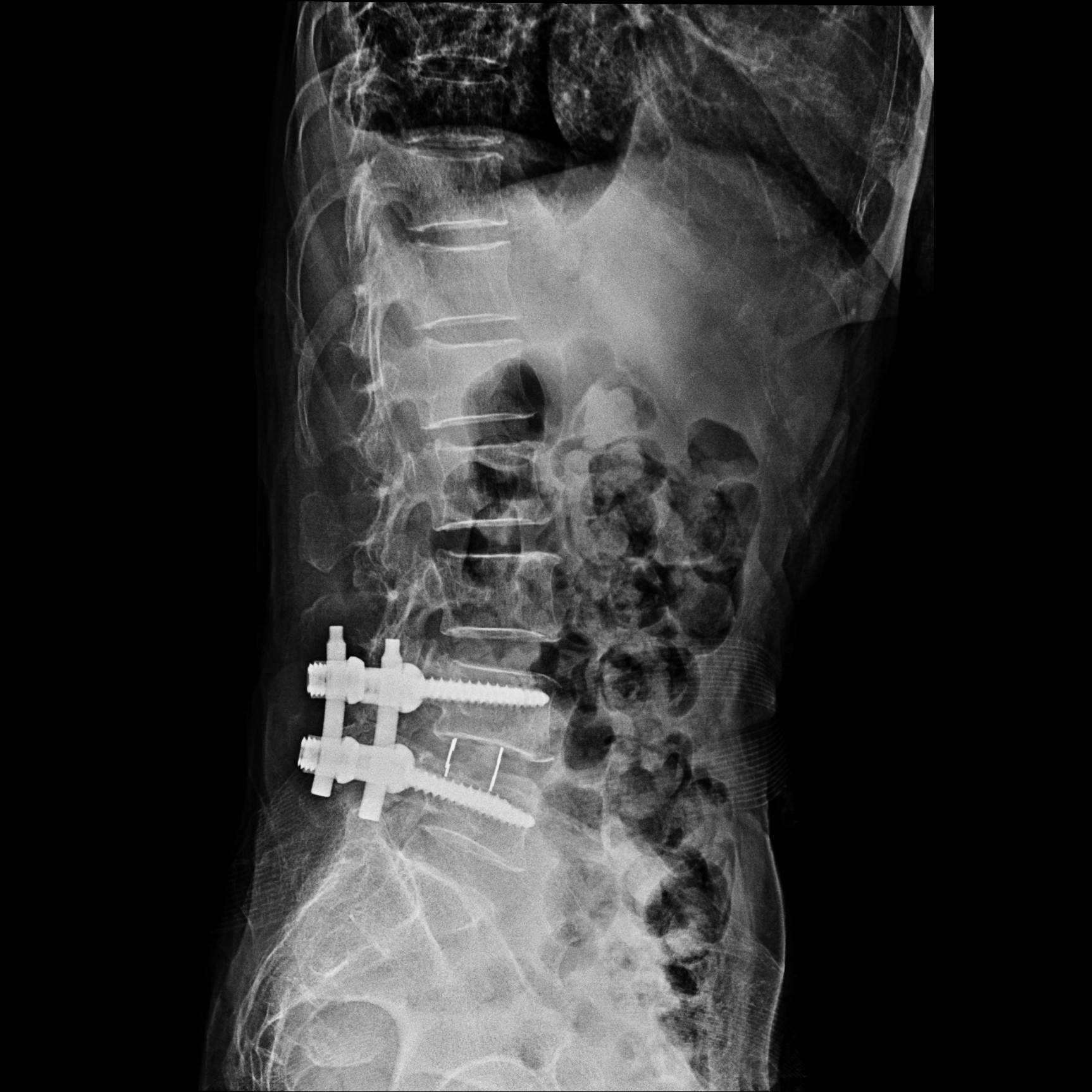 你知道吗腰痛的病因差别很大,腰痛何因