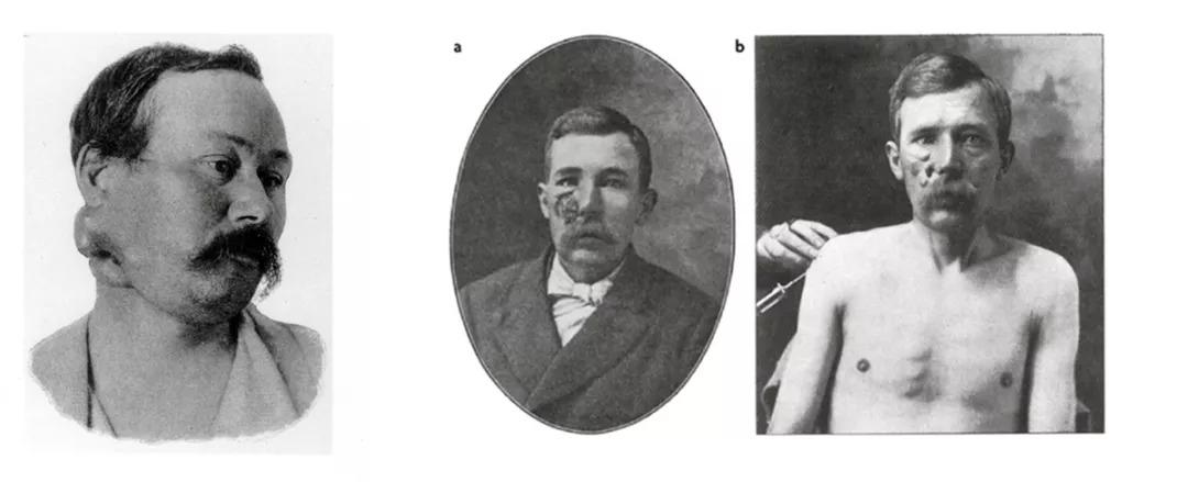 中国创新药现状,中国原创药与国外的差距