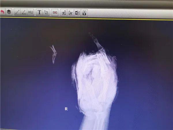 医院疫情防控日常救治,医院疫情医疗救治措施