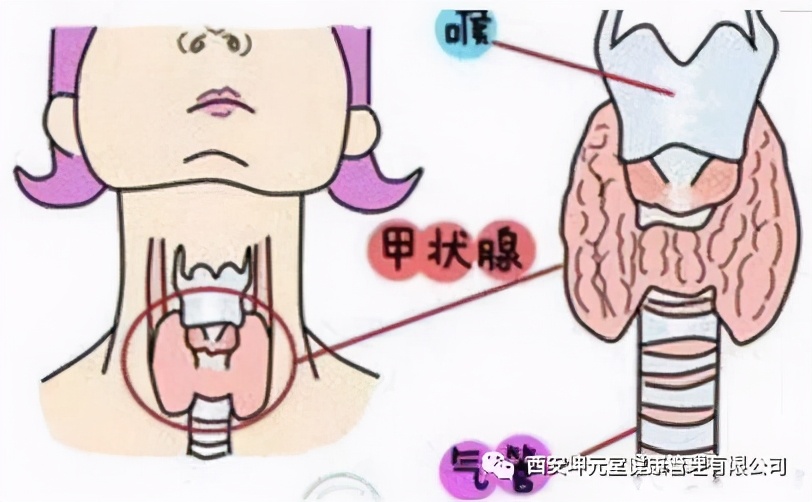 中医讲堂：截根术治疗甲状腺结节有奇效