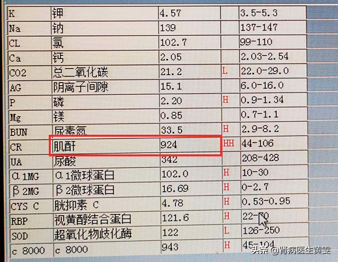 肌酐高吃药不降反增怎么办能治吗,肌酐低透析好还是等肌酐高透析好
