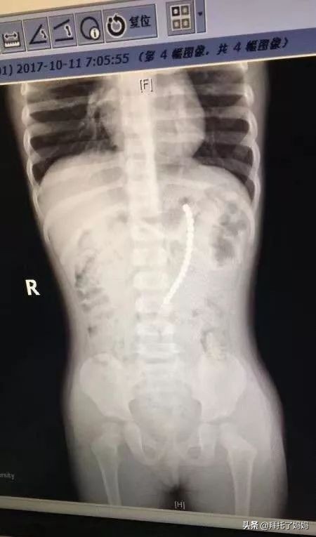 被禁售的10大危险玩具,十大危险玩具慎买